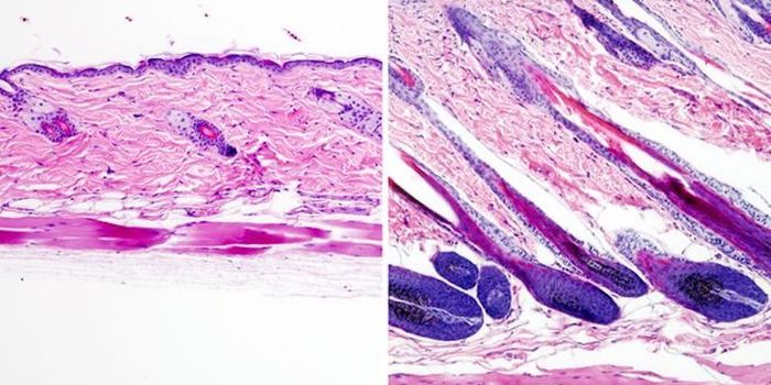 Stem Cell Activation Causes Hair to Grow