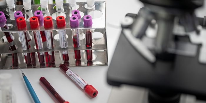 What Makes A Strong Antibody Response to Coronavirus