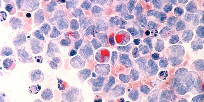 A Vaccine for When Cancer Forms from Human Retroviruses