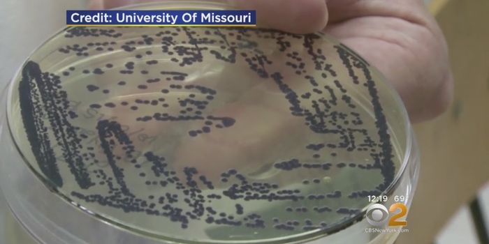 Using Bacteria to Kill Cancer Cells