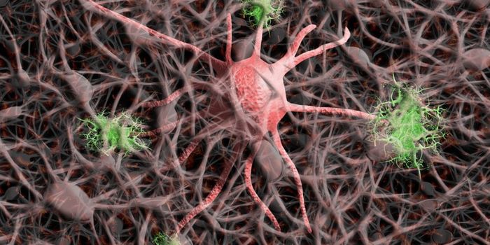 Scientists Find Several Crucial New Insights Into Huntington's Disease