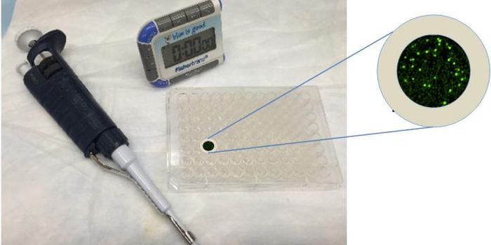 "CaFlux" Test for the Unpredictable Immune System