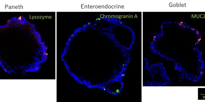 Crucial Niche Factors for Organoid Cultures