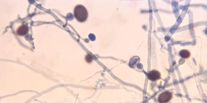 Scientists Discover A Novel Way That Bacteria Infect Cells