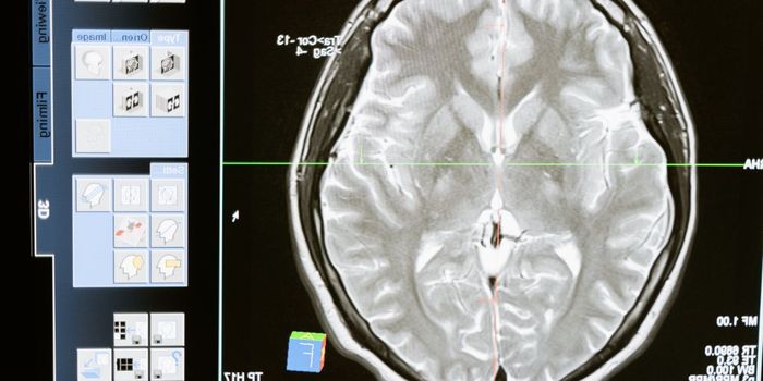 Non-drug Interventions for Alzheimer's are Cost Effective