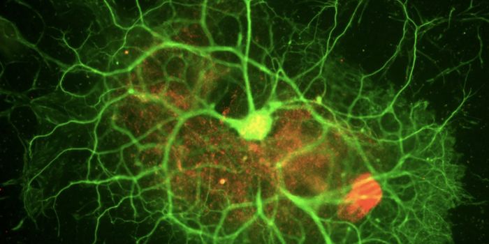 Brain Organoids May Not be Living Up to the Hype