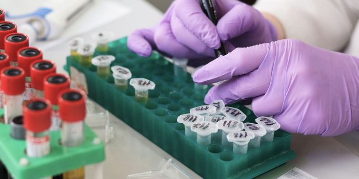 A Genetic Form of ALS is Discovered