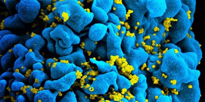 CAR-T Cells that Kill Cancer Now Kill HIV Too