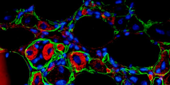 Technology Optimizes Cancer Therapy with Nanomedicine Drug Combinations