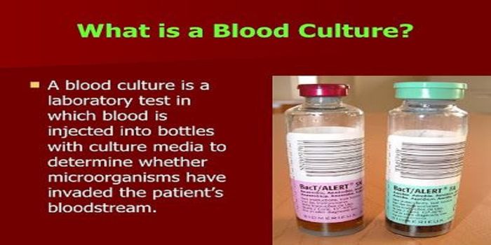 Rapid Idenditfication of Microorganisms in Positive Blood Cultures Using MALDI-TOF MS