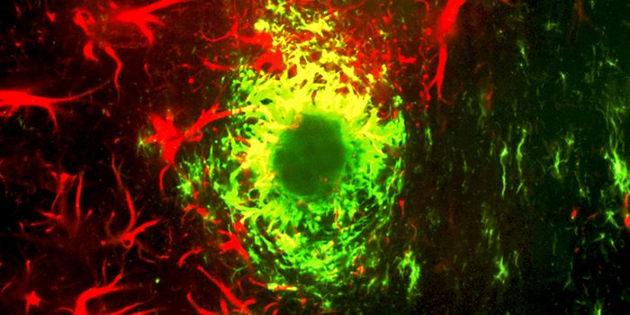 Combining Antidepressants with Blood Thinners to Slow Brain Cancer