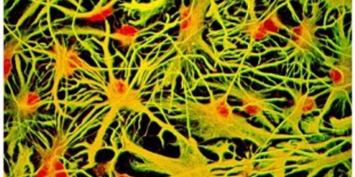Protein could be key to whether people get Alzheimer