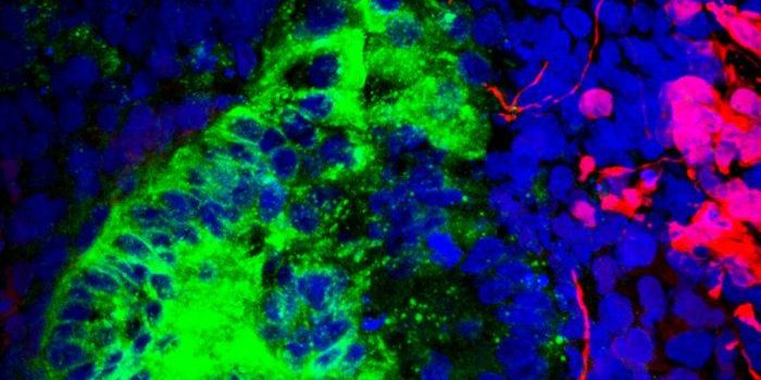 Preventing the Wrong Cells From Forming in Organoids