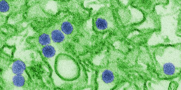 Scientists Exploit Zika to Kill Brain Cancer