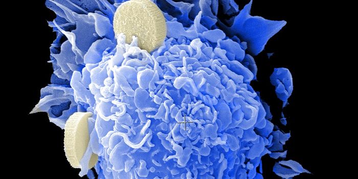Platelets May Protect Cancer Against PD-1 Therapies