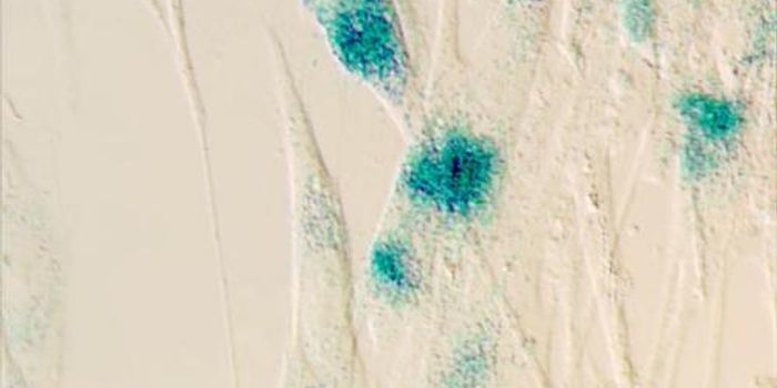 Cell Division Ceases When CD36 Kicks in