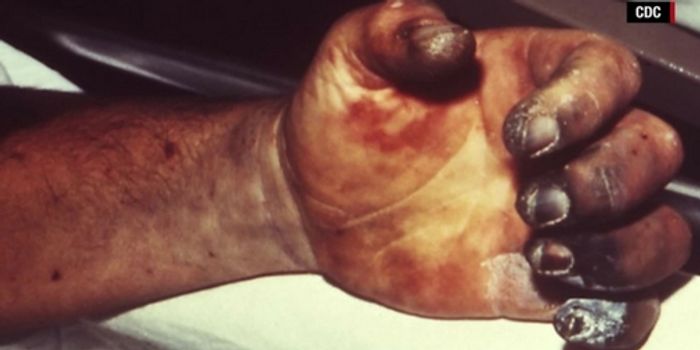 The Plague Returns With the Dead in Madagascar