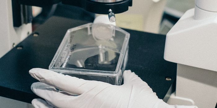 Targeting CB1 Receptors With Antibodies