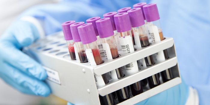 Novel ALS Variants ID'ed, Now 1 in 4 Patients Have Genetic Cause