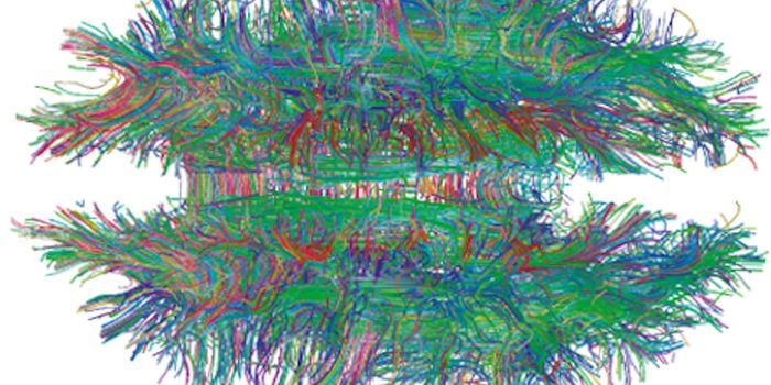 One Gene is a Hotspot for Mutations Related to Autism