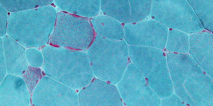 Questions About Mitochondrial Replacement Therapy Efficacy Arise