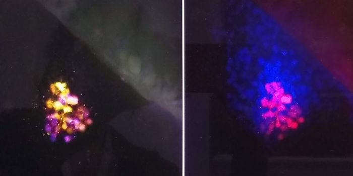 Removing One Gene From One Cell Type Protects Against Type 1 Diabetes