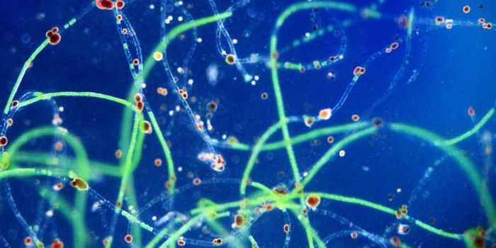 Better Know a Microbe: Vampire Amoebas!