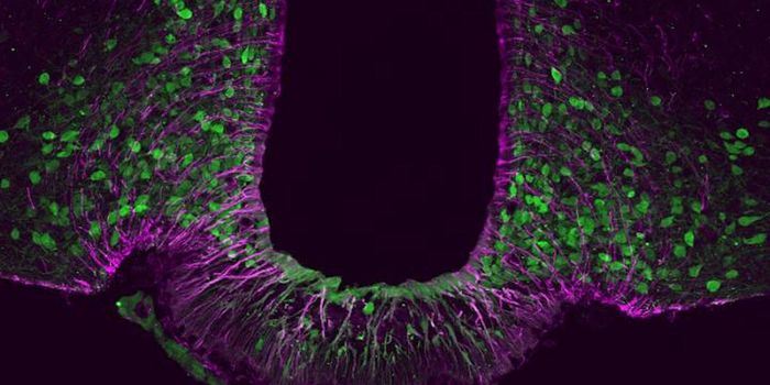 Neuronal Identity Crisis in the Hypothalamus can Lead to Obesity