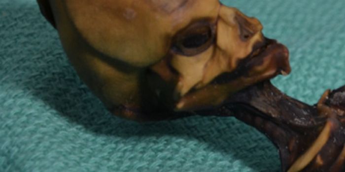 Mystery Solved: The Atacama Skeleton is not an Alien