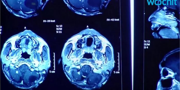 The Hypnotized Brain Looks Different to Neurobiologists