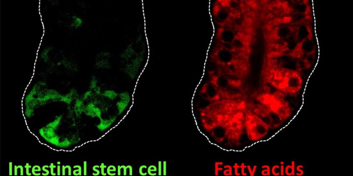Linking Intestinal Stem Cells with Increased Cancer Risk From a High-Fat Diet