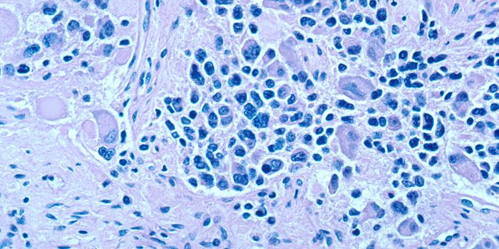 Mysterious Extrachromosomal DNA is Linked to Childhood Cancer