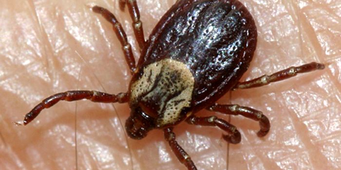 Tick Bite Causes Harmful Disease and the Amputation of a Woman's Arms and Legs