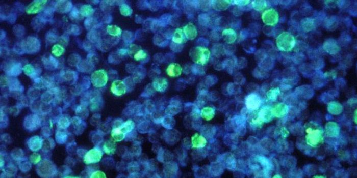 An Immune Reaction to EBV can Lead to MS-Related Brain Damage