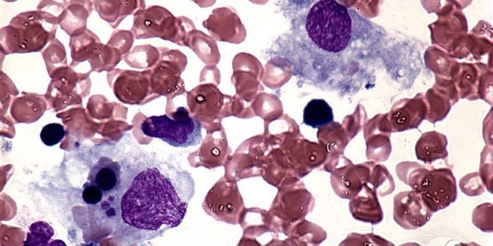 The Flu Probably Won't Kill You, But This Side Effect Might