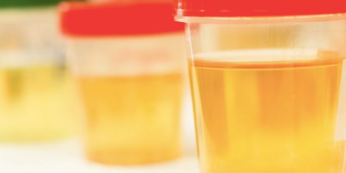 Why is Urine Yellow? Scientists Find the Enzymatic Reason