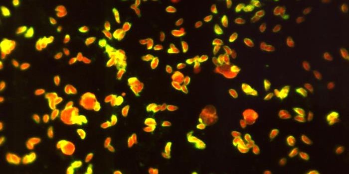 Learning More About Toxoplasmosis