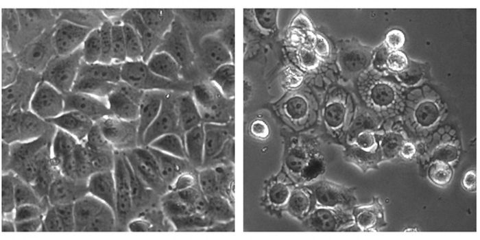 Overstimulating Cancer Cells