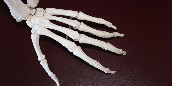 Study Examines Effectiveness of Medical Cannabis Treatments for Arthritis