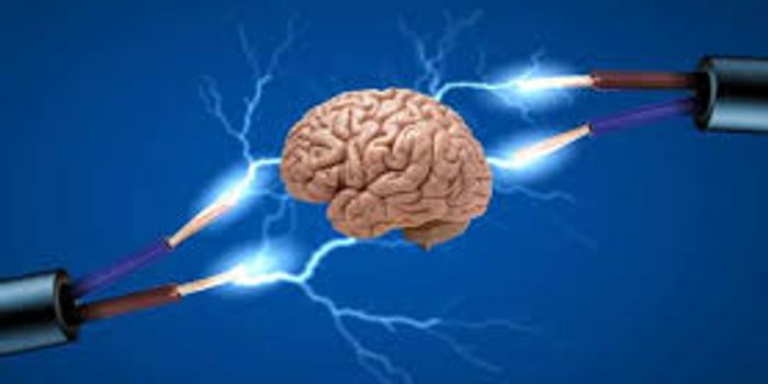 Stentrode: No Surgery Focused Brain stimulation