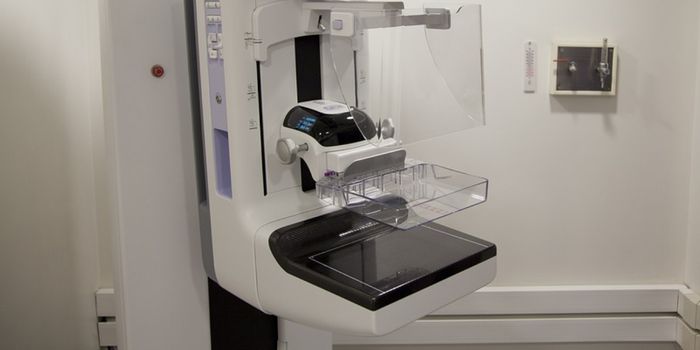 How Beneficial are Additional Breast Cancer Screens?