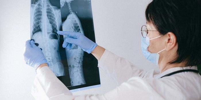 Using AI to triage chest pain patients