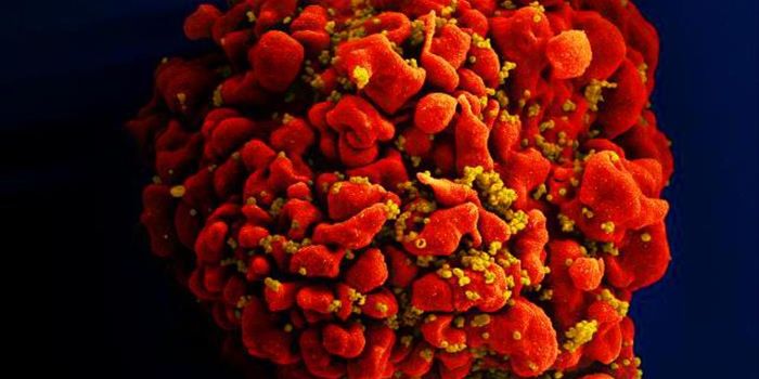 Human Genes That are Essential to HIV Offer New Insights on Chronic Infection