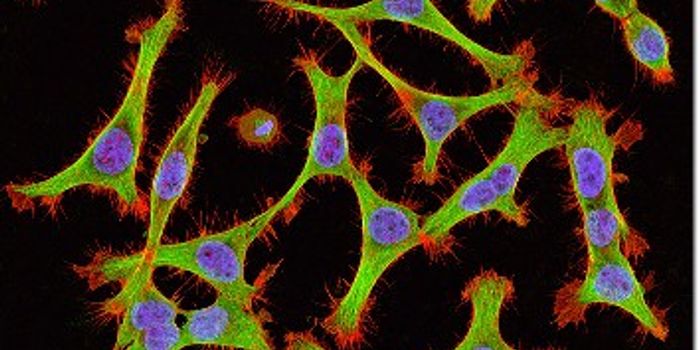 Orgenesis will use grant money to do further research on cures for diabetes and other diseases.