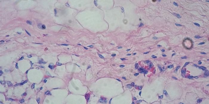 Heart Hormone Could Prevent Type 2 Diabetes, Obesity