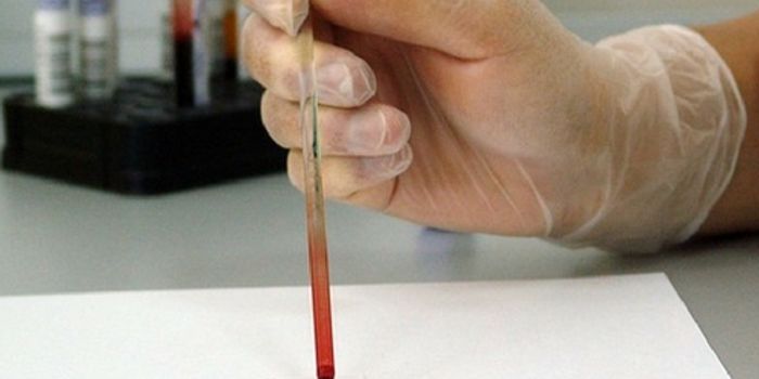 Diagnosing a Concussion With a Blood Test