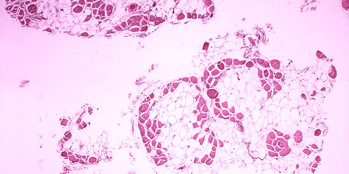 Improving Heart Function for People with Duchenne Muscular Dystrophy