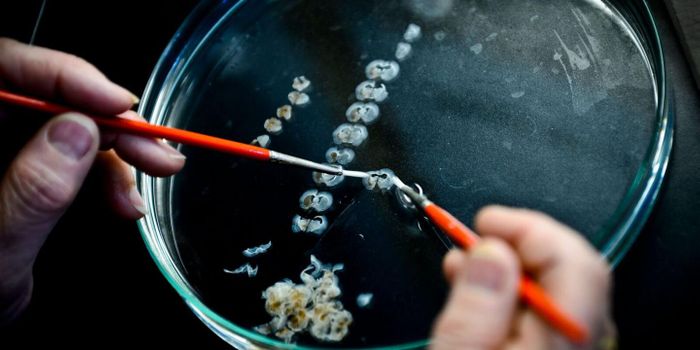 Stem Cells as a Potential Treatment for Parkinson's Disease