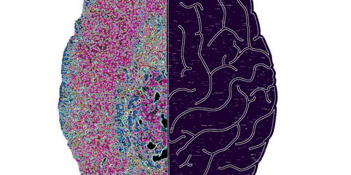 Dealing With A Paralyzed Immune System