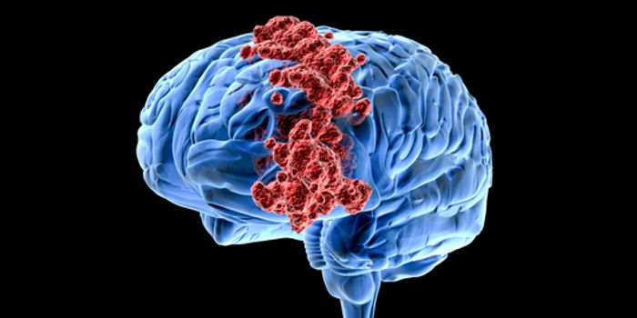 New Protein Target Deals Brain Cancer A Two-In-One Punch